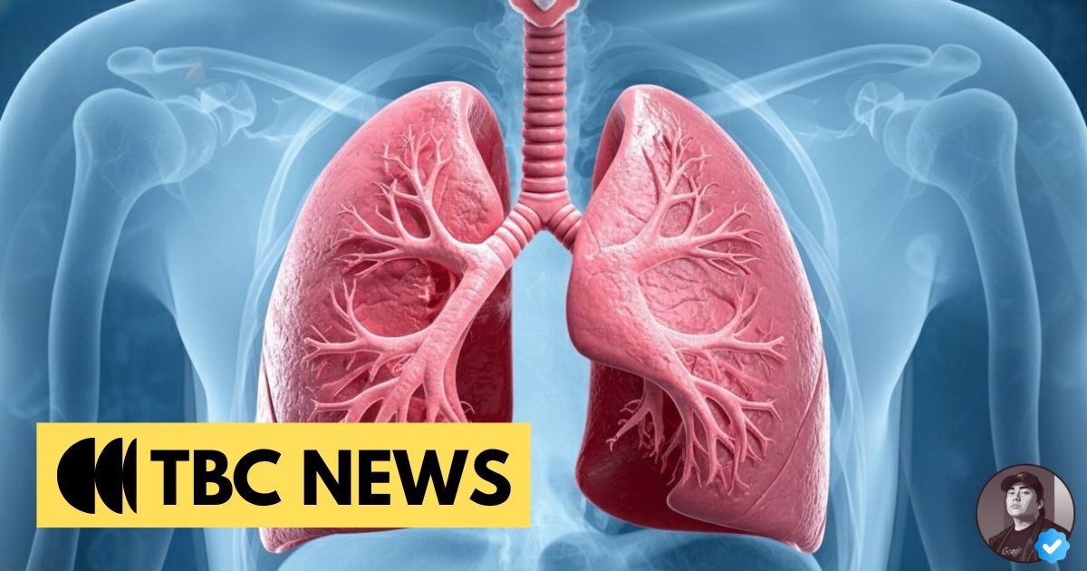St. Luke’s – Global City launches a dedicated inhaler clinic to enhance pulmonary care