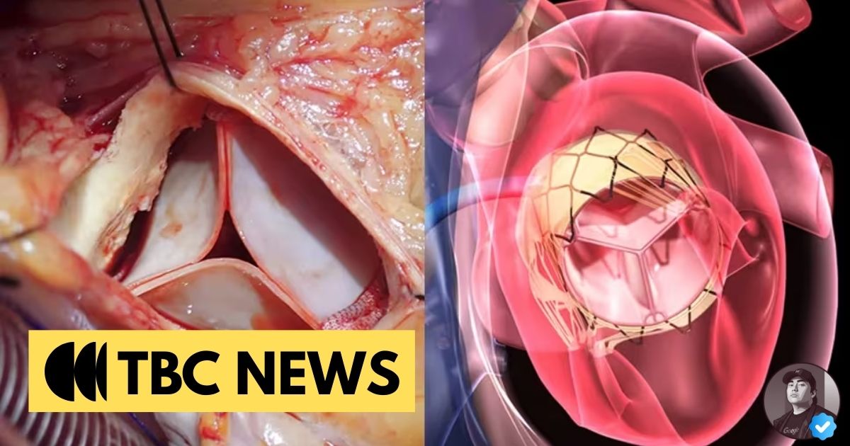 St. Luke’s Establishes New Standard in Structural Heart Care